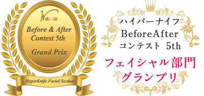 CONCEPT 本気で小顔になりたい人に来てほしい